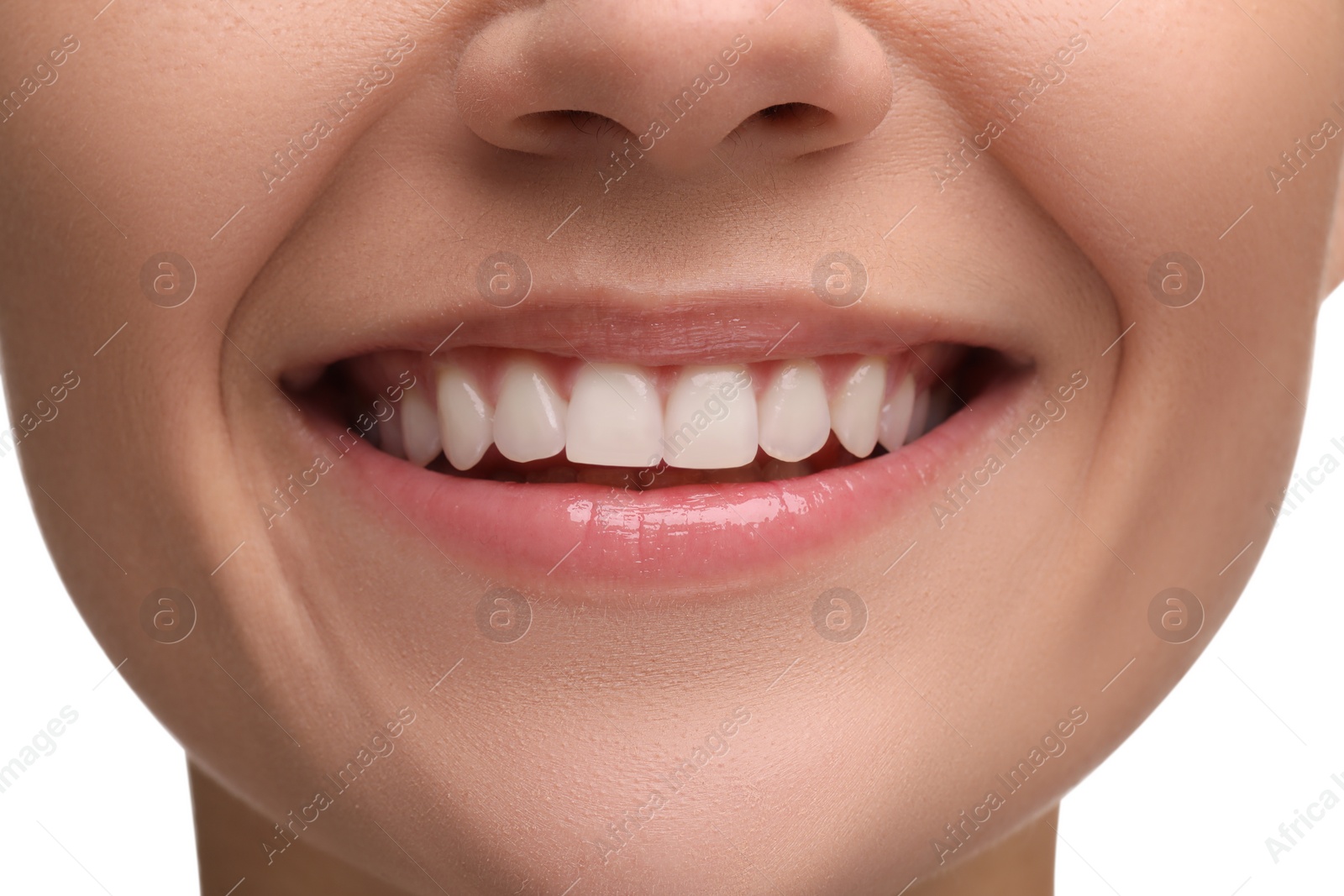 Photo of Woman with clean teeth smiling on white background, closeup