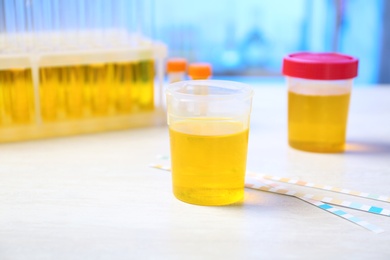 Photo of Container with urine sample for analysis on table in laboratory