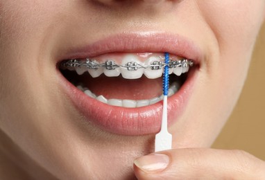 Photo of Woman with dental braces cleaning teeth using interdental brush, closeup