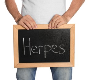 Photo of Man holding small chalkboard with word Herpes on white background, closeup