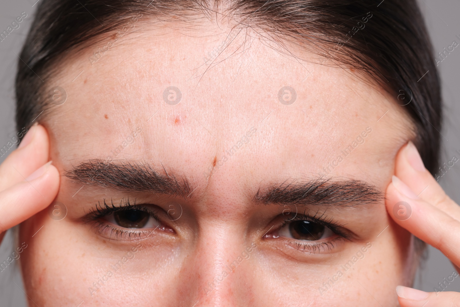 Photo of Closeup view of woman with wrinkles on her forehead against grey background