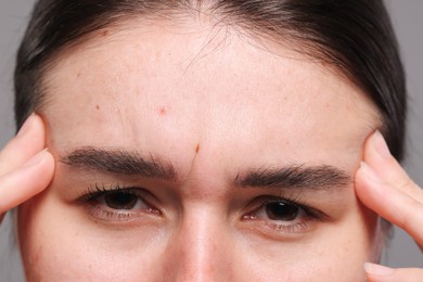 Closeup view of woman with wrinkles on her forehead against grey background