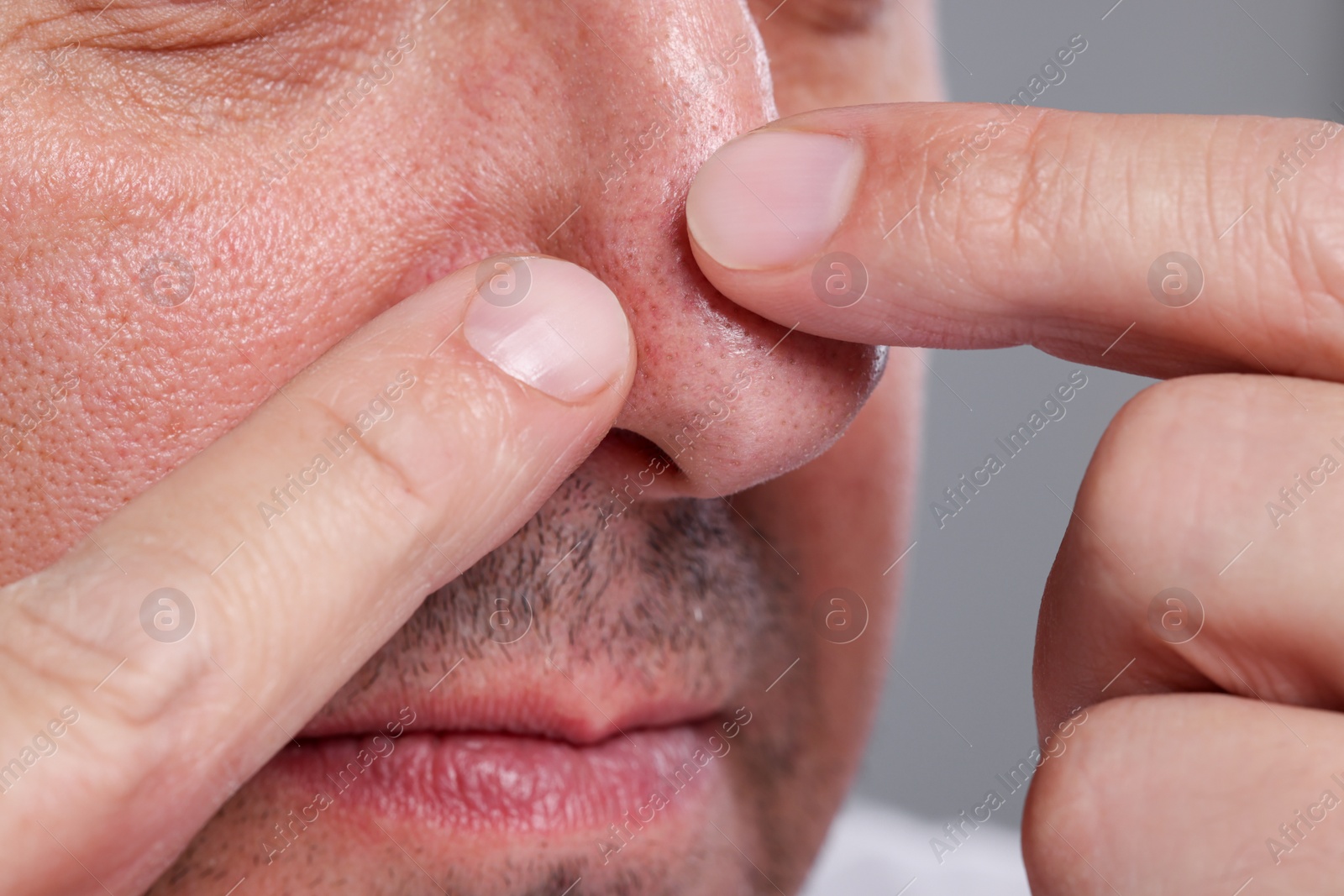 Photo of Man popping pimple on his nose against grey background, closeup