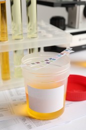 Photo of Container with urine sample for analysis on table