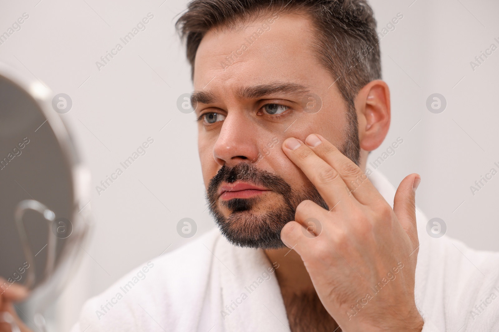 Photo of Man with skin problem looking at mirror indoors