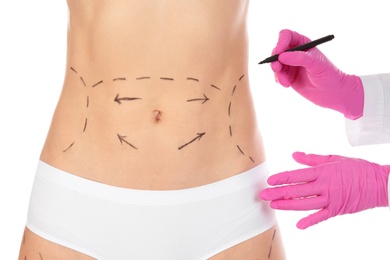 Doctor drawing marks on woman's body isolated on white. Cosmetic surgery