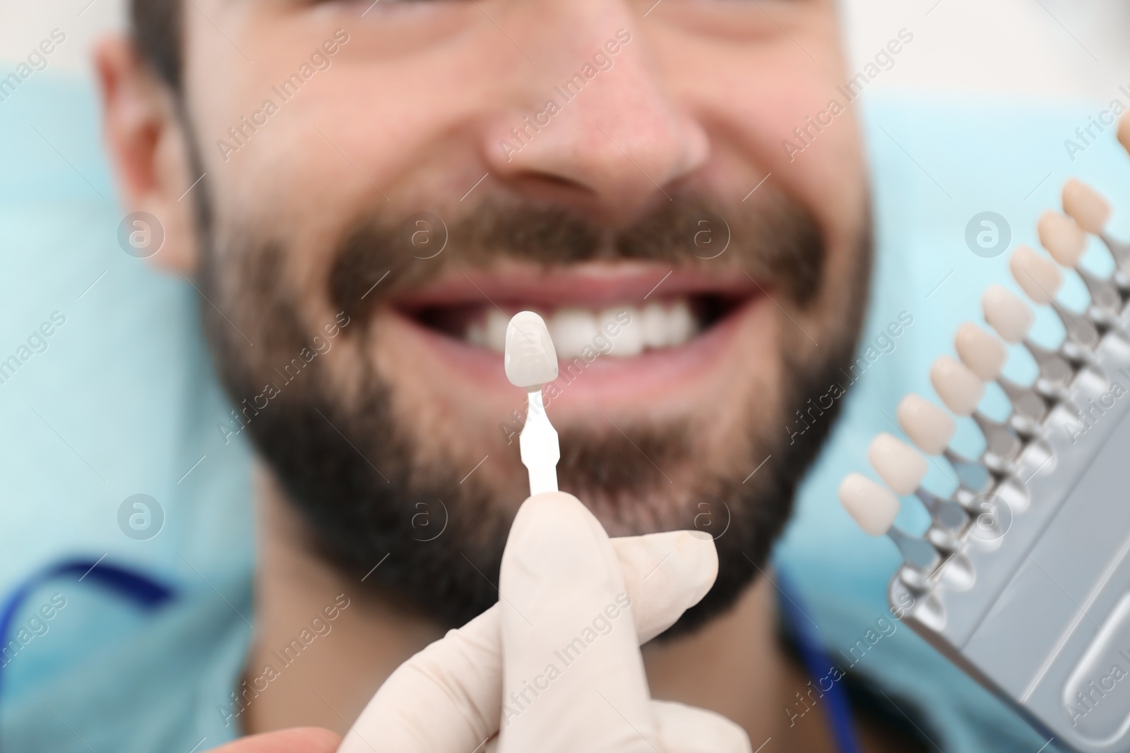 Photo of Dentist matching young man's teeth color with palette, closeup