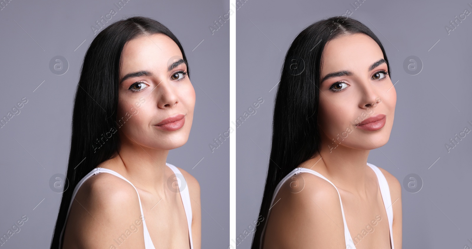 Image of Collage with photos of beautiful young woman before and after using mattifying wipes on grey background. Banner design