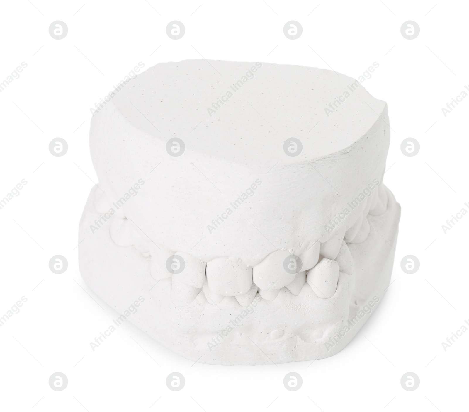 Photo of Dental model with gums isolated on white. Cast of teeth