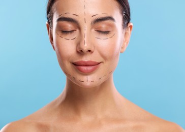 Photo of Young woman with marks on face for cosmetic surgery operation against light blue background