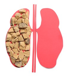Photo of Kidneys paper cutout and stones on white background, top view