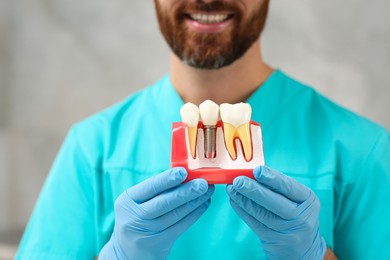 Dentist holding educational model of dental implant on blurred background, closeup