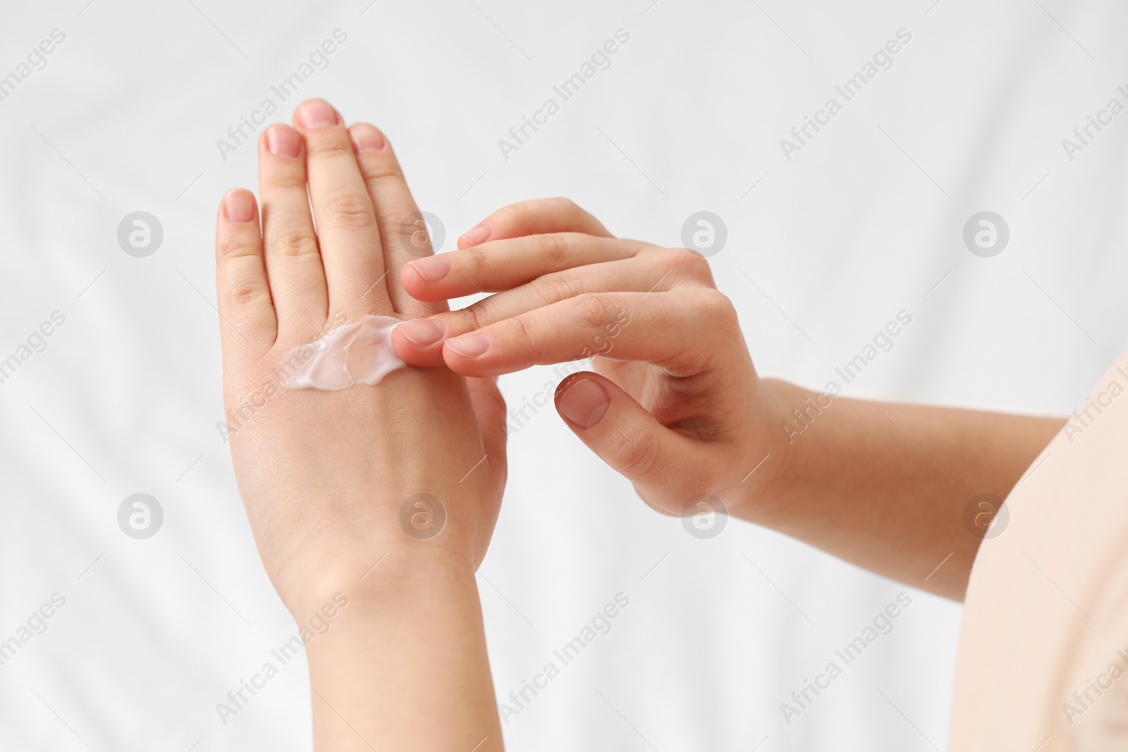 Photo of Young woman with dry skin applying cream onto her hand on bed, closeup