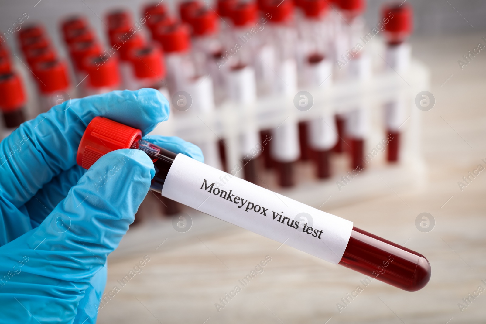 Photo of Laboratory worker holding test tube with blood sample near rack, closeup