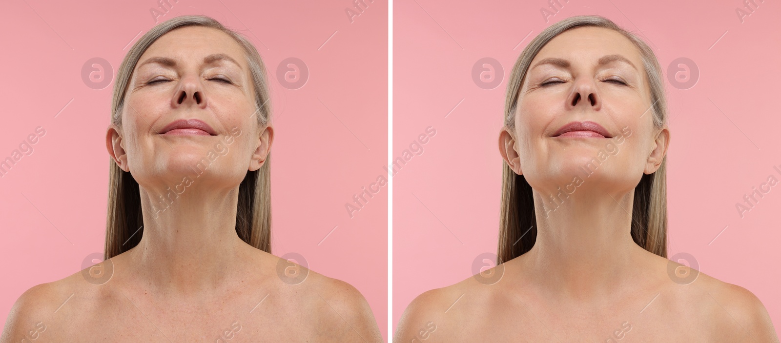 Image of Aging skin changes. Collage with photos of mature woman before and after cosmetic procedure on pink background