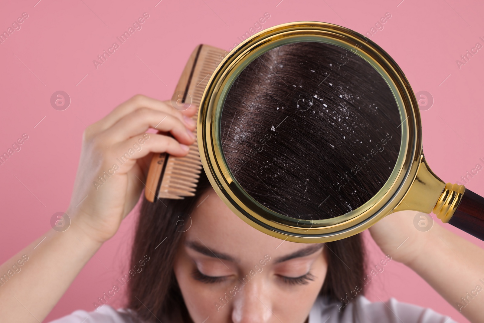 Image of Woman suffering from dandruff on pink background, closeup. View through magnifying glass on hair with flakes