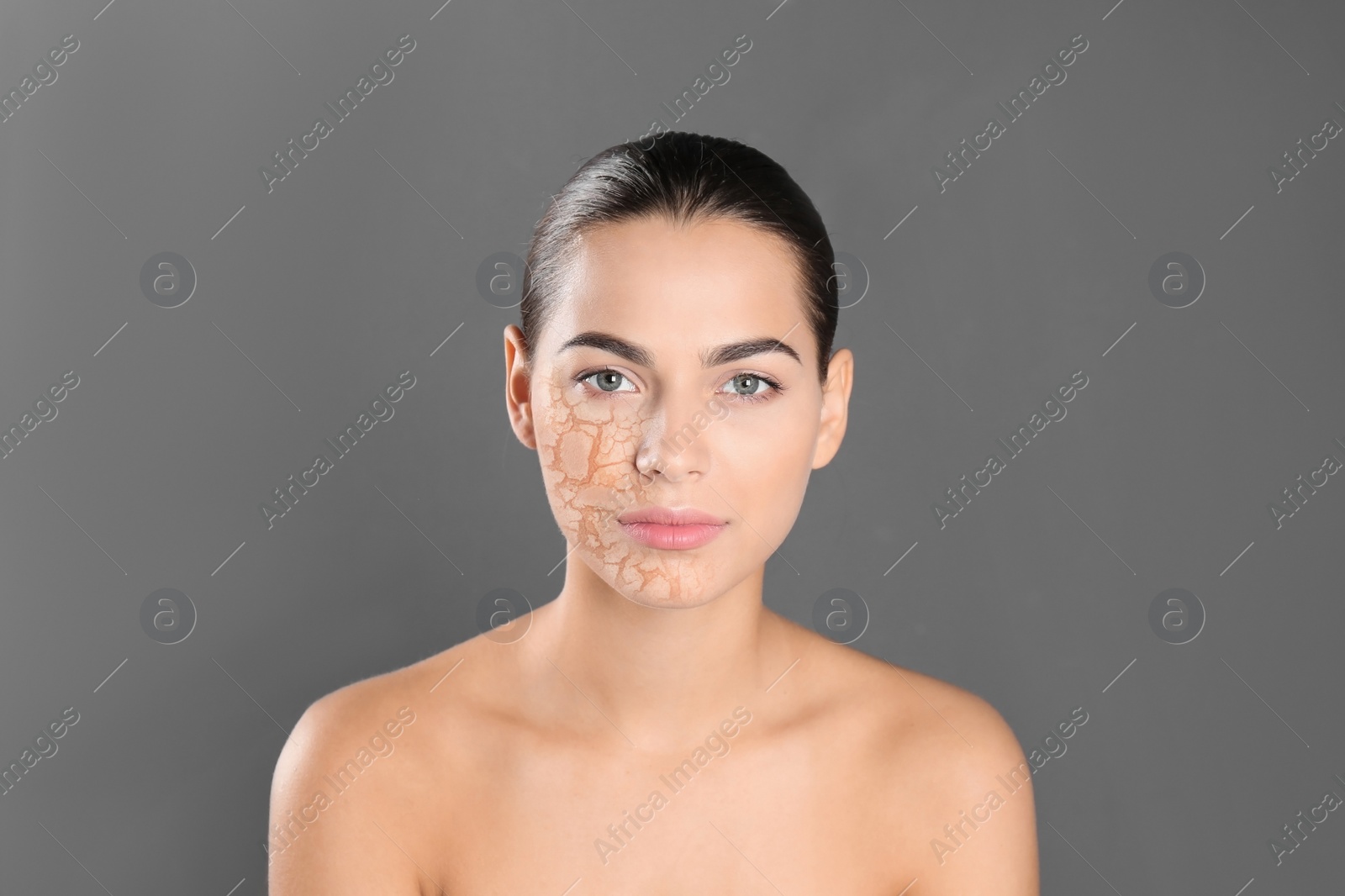 Image of Beautiful young woman with dry skin on grey background