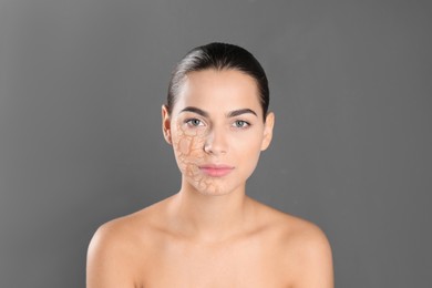 Beautiful young woman with dry skin on grey background