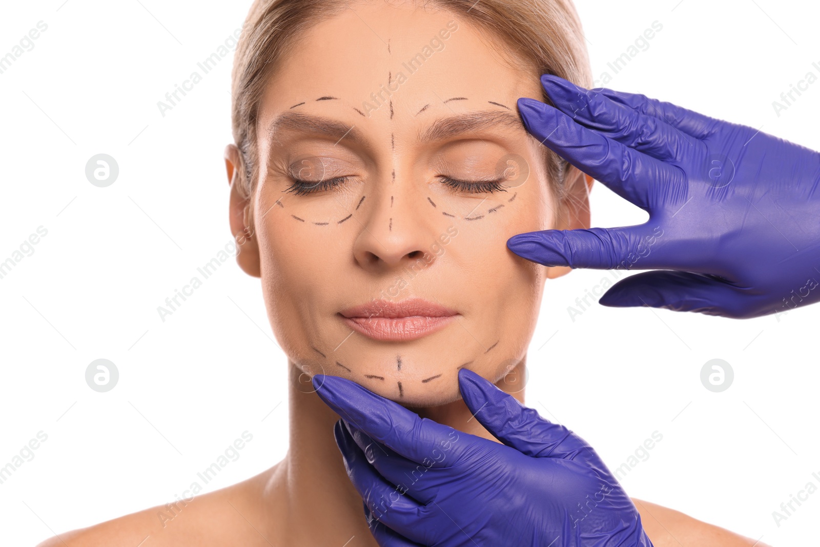 Photo of Doctor checking patient's face before cosmetic surgery operation on white background, closeup