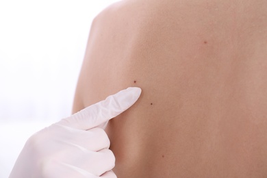 Photo of Dermatologist examining patient in clinic, closeup view