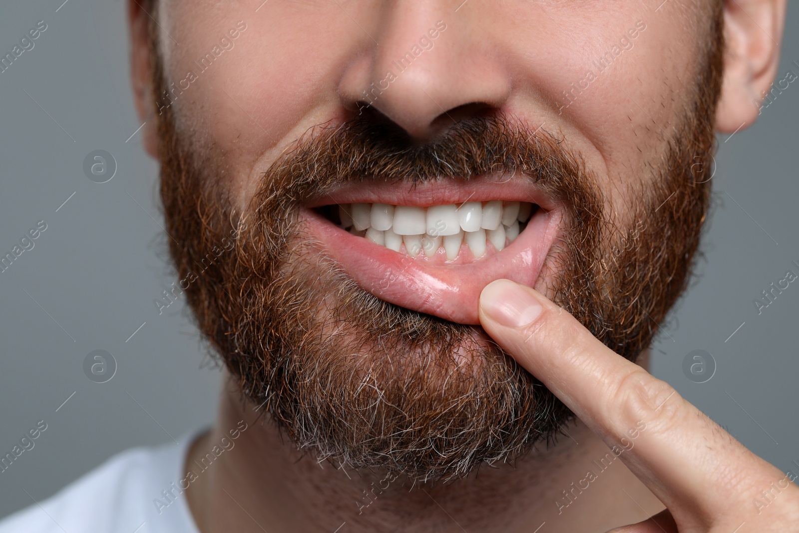 Photo of Man showing healthy gums on gray background, closeup