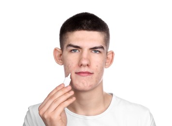 Photo of Young man with acne problem applying cosmetic product onto his skin on white background