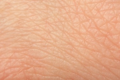 Photo of Texture of healthy skin as background, macro view