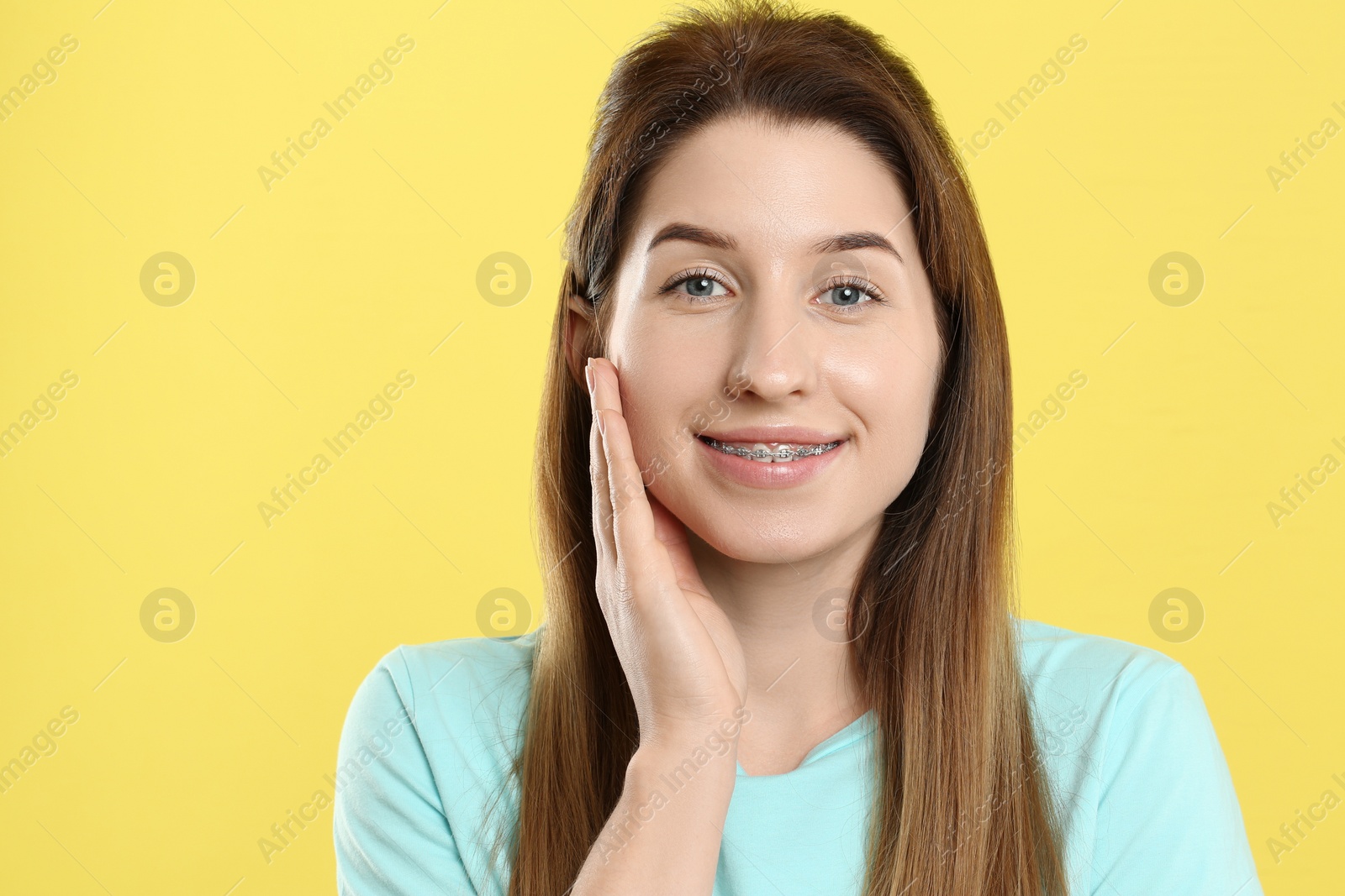 Photo of Portrait of smiling woman with dental braces on yellow background. Space for text