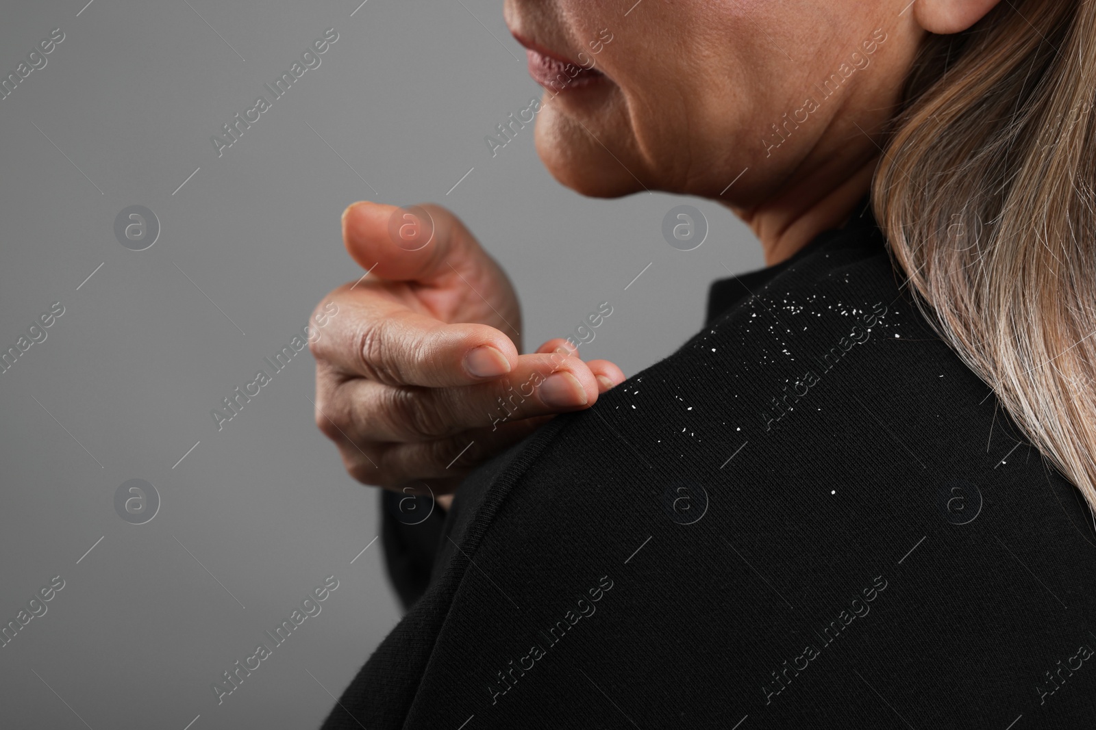 Photo of Woman brushing dandruff off her sweater on gray background, closeup