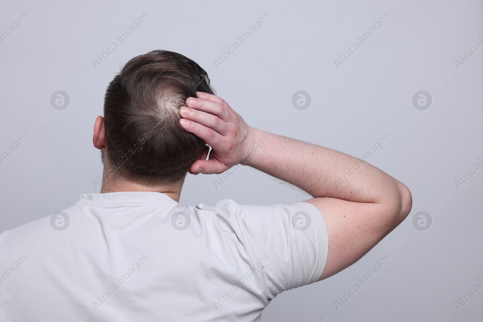 Photo of Baldness concept. Man with bald spot on light grey background, back view