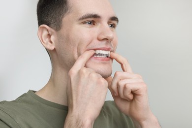 Young man applying whitening strip on his teeth against light grey background. Space for text
