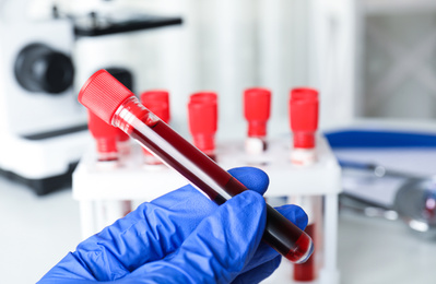 Photo of Scientist holding test tube with blood sample at table, closeup. Virus research