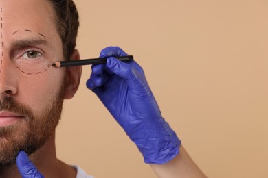 Photo of Doctor drawing marks on man's face for cosmetic surgery operation against beige background, closeup