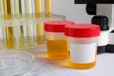 Containers with urine samples on table in laboratory, space for text. Specimen collection