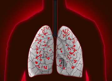 Illustration of Man with diseased lungs on red background. Illustration