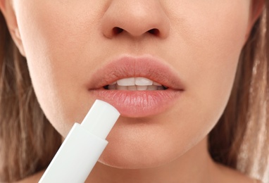 Photo of Young woman with cold sore applying lip balm, closeup