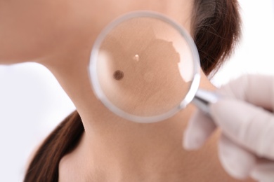 Dermatologist examining patient with magnifying glass in clinic, closeup view