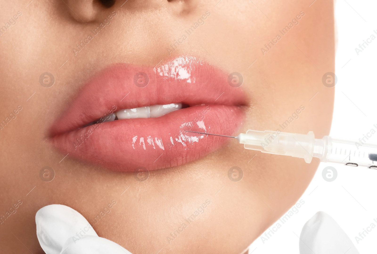 Photo of Young woman getting lips injection on white background, closeup
