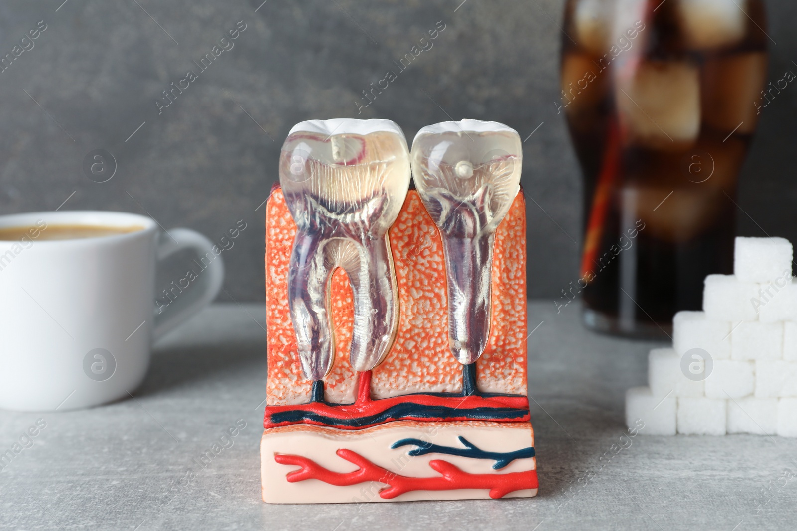 Photo of Educational model of jaw section with teeth and sugar on grey table