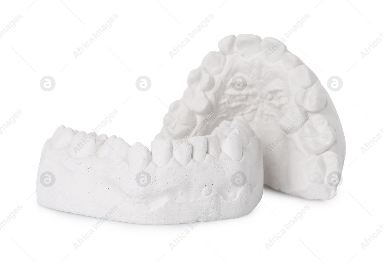 Photo of Dental model with gums isolated on white. Cast of teeth