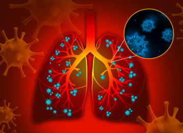 Illustration of  human lungs affected with disease on red background