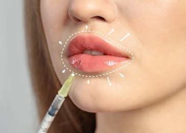 Young woman getting lips injection, closeup. Cosmetic surgery