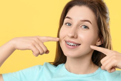 Smiling woman pointing at her dental braces on yellow background