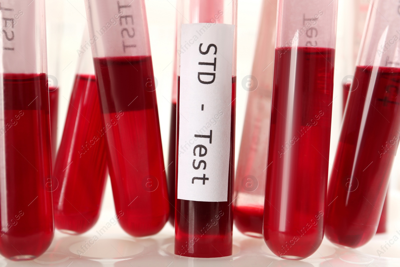 Photo of Tubes with blood samples in rack on white background, closeup. STD test