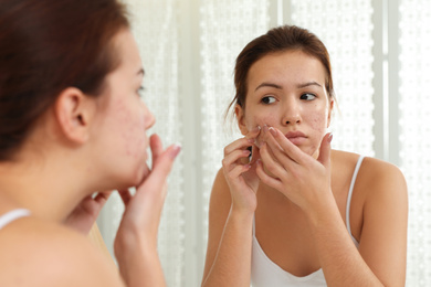 Teen girl with acne problem squeezing pimple near mirror in bathroom
