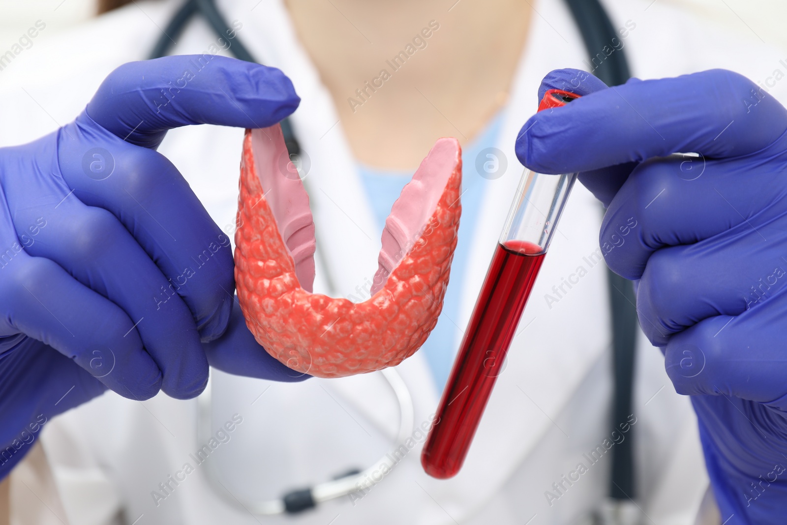 Photo of Endocrinologist showing thyroid gland model and blood sample in test tube, closeup