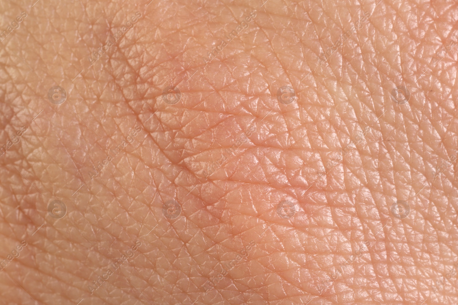 Photo of Texture of healthy skin as background, macro view