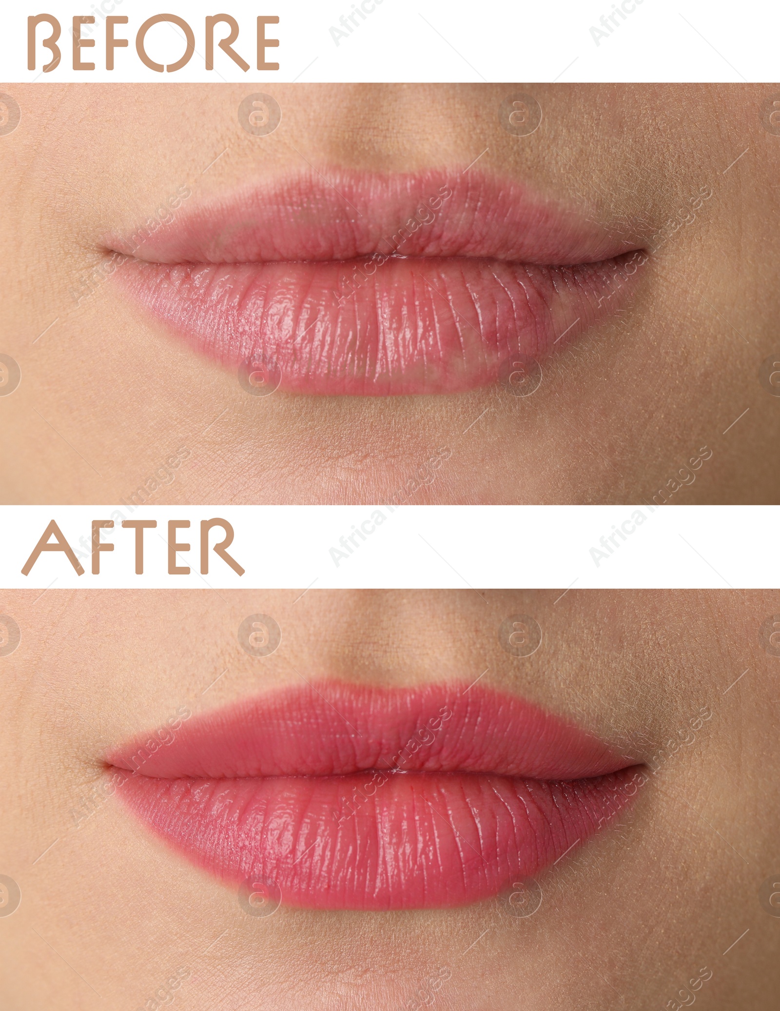 Image of Collage with photos of young woman before and after permanent lip makeup, closeup