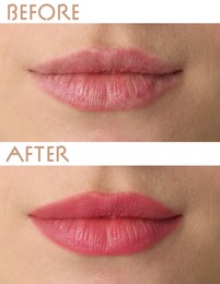 Image of Collage with photos of young woman before and after permanent lip makeup, closeup