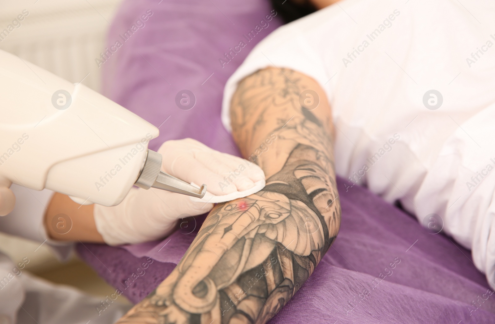 Photo of Young woman undergoing laser tattoo removal procedure in salon, closeup